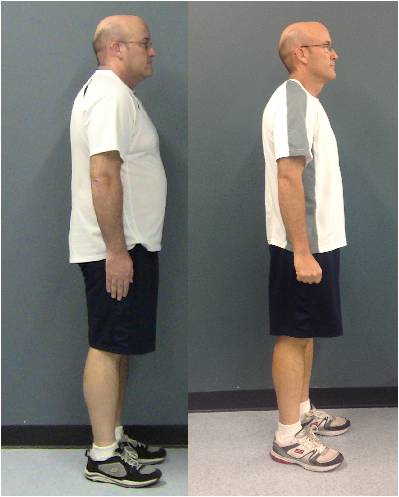 Photo: Chris Pignetti's Before and After Profile